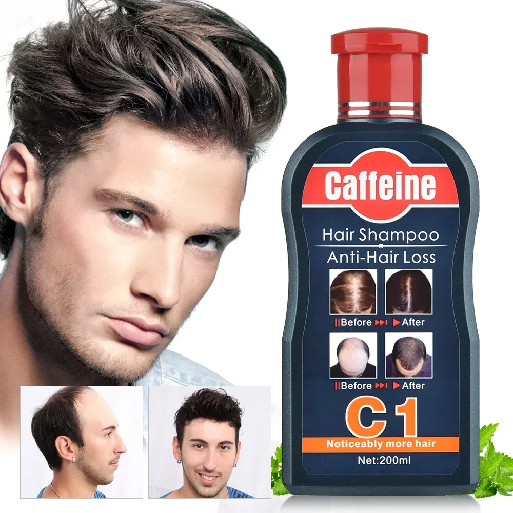 Men Shampoo For Hair Growth Na - Hair Care Korean Products 评论和价格